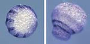 左はクモの正常胚、右はdsRNAiを行った胚